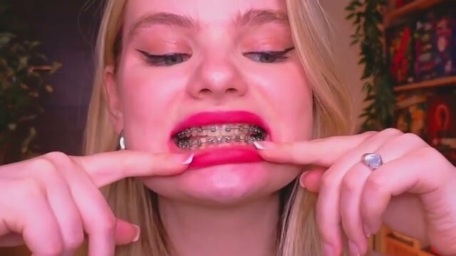 Braces & Beauty: A Seductive Surprise