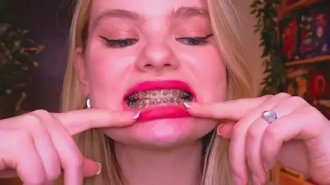 Braces & Beauty: A Seductive Surprise