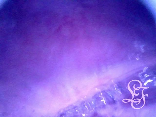 I really love taking a look into my deepest insides!
