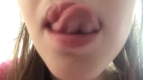 Braces Beauty Shows Off Cute Smile